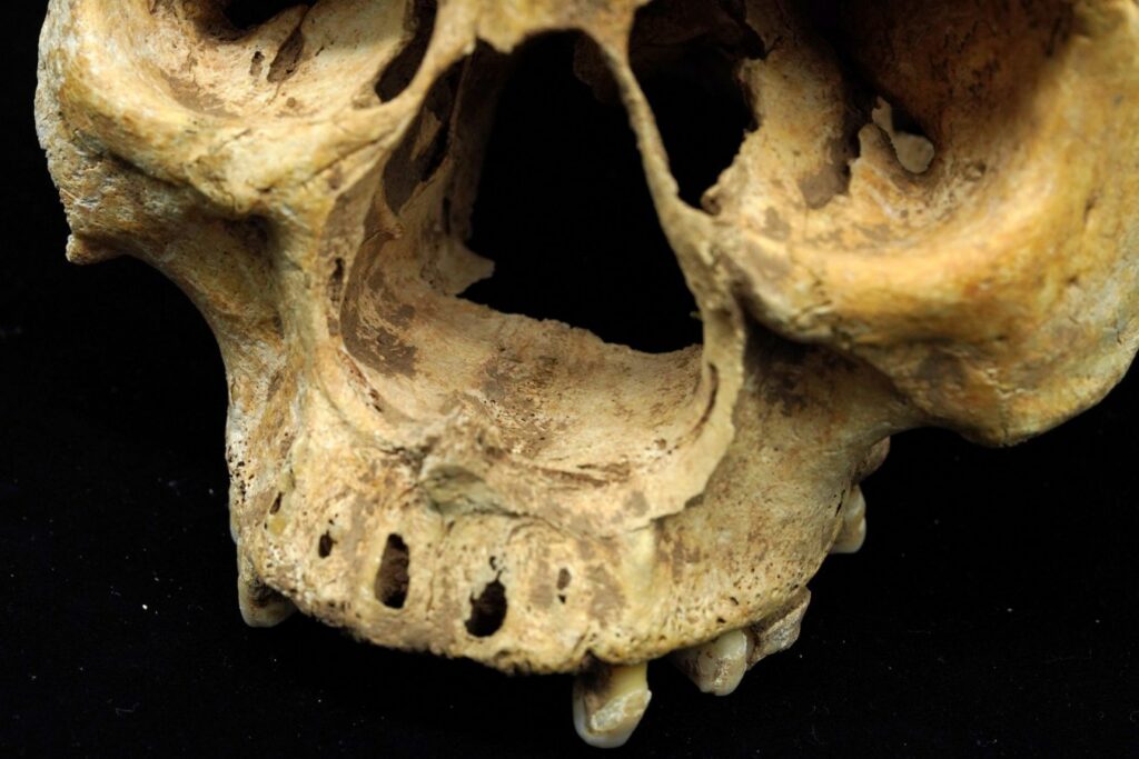 Una donna dell’impero cinese aveva il naso amputato
